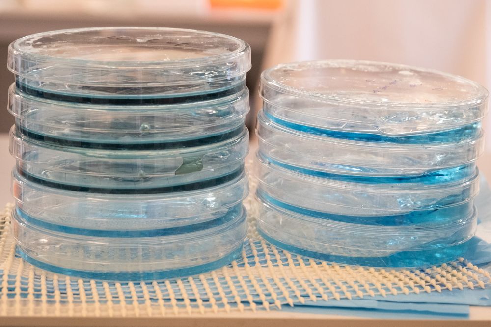 Petri dishes in Birsoy lab