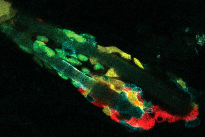 A hair follicle with stem cells in green, dying cells and debris in orange, and professional phagocytes in purple