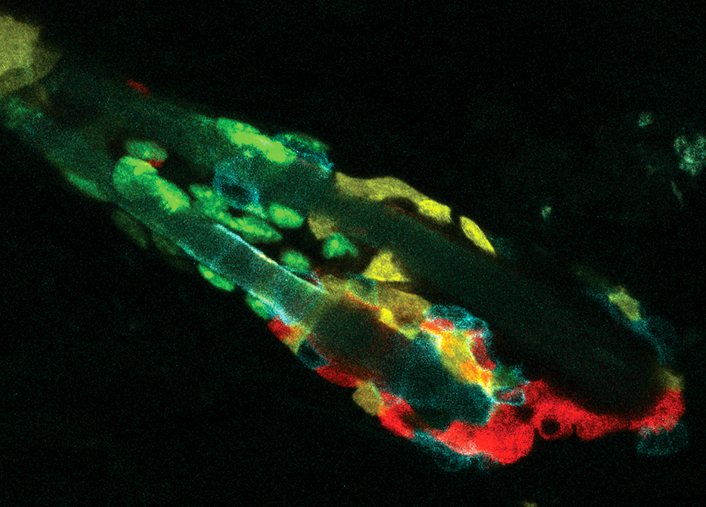 A hair follicle from the confetti mouse containing phagocytic stem cells (single cells with two fluorescent colors) and non-phagocytic stem cells (a s