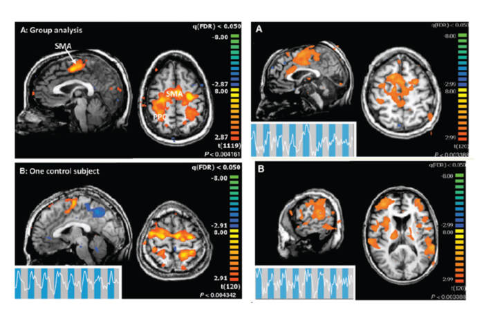 brain scans in four quadrants