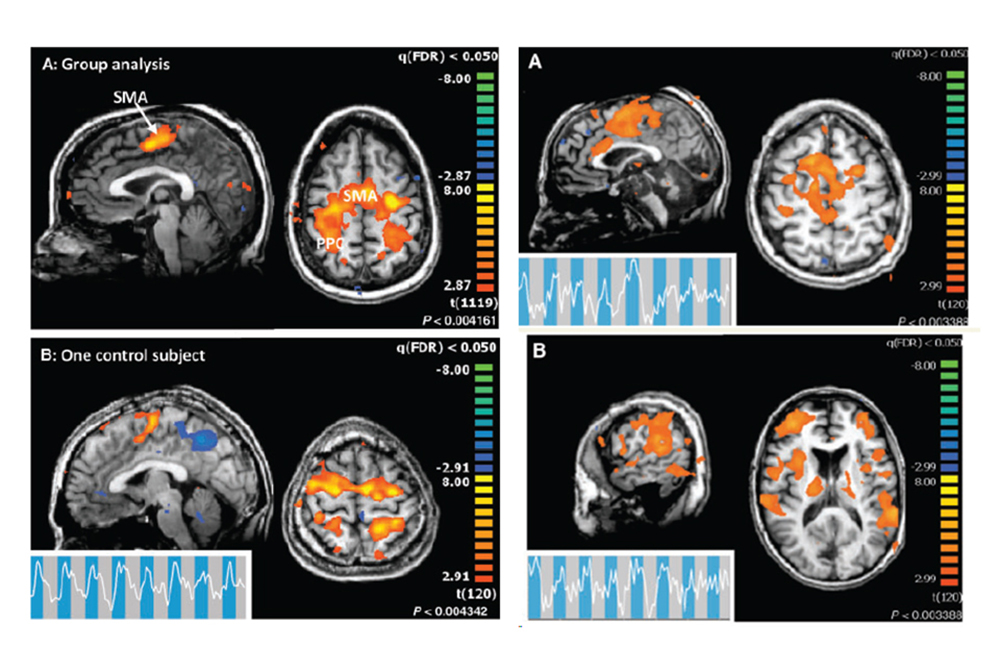 brain scans in four quadrants