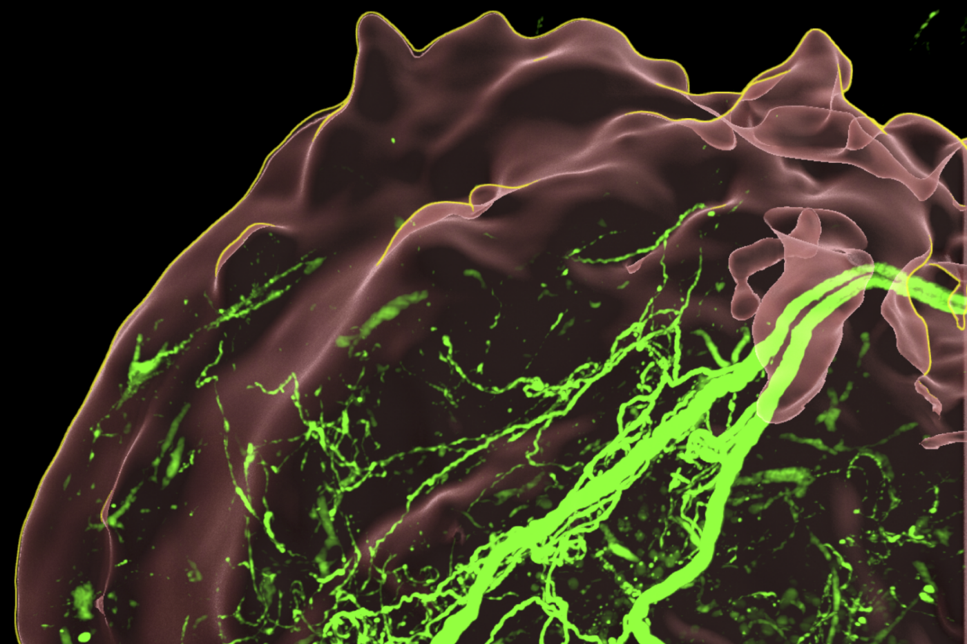 tavazoie cancer sensory nerves