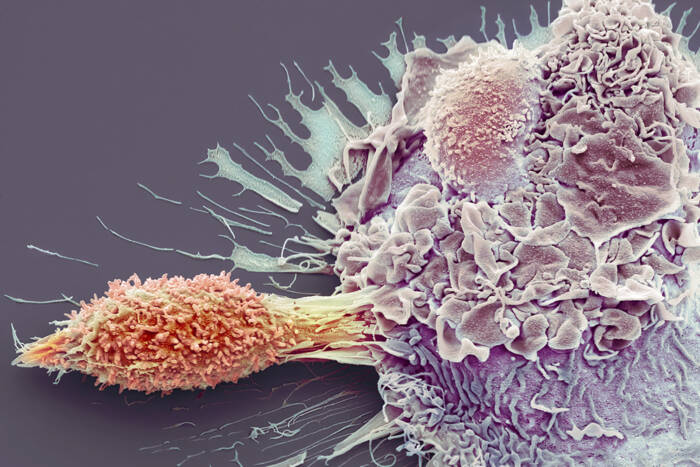 A colored SEM of a T cell and macrophage interacting