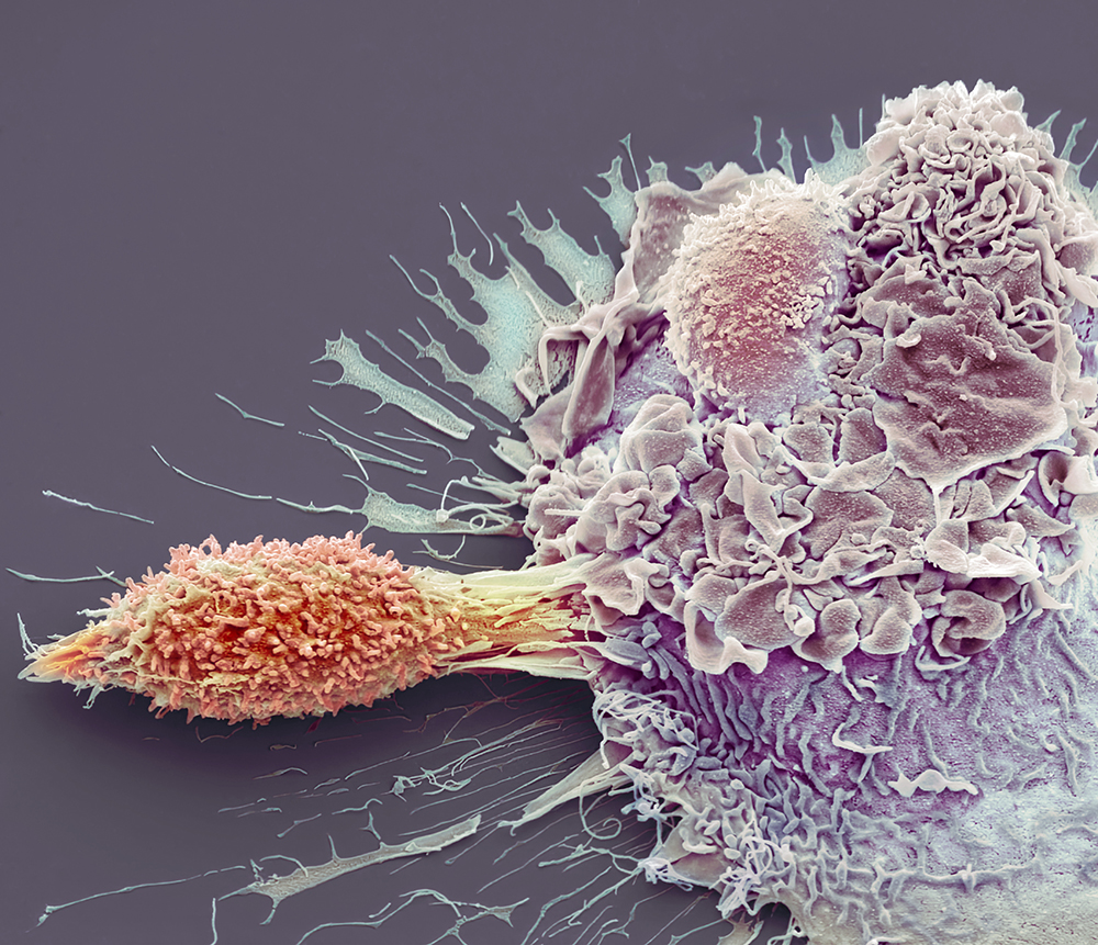 A colored SEM of a T cell and macrophage interacting