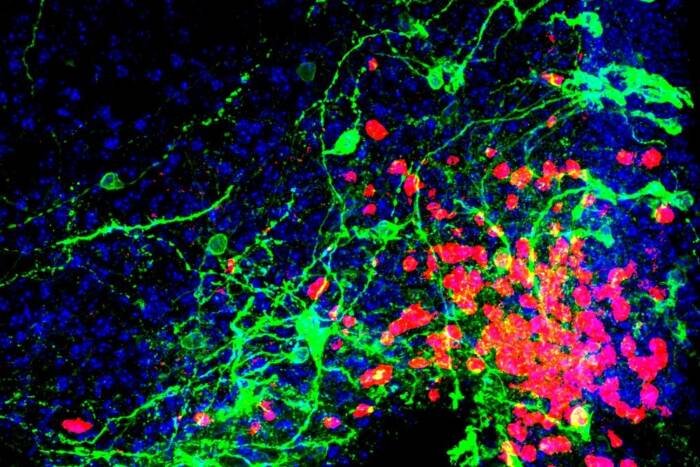 satiety neurons