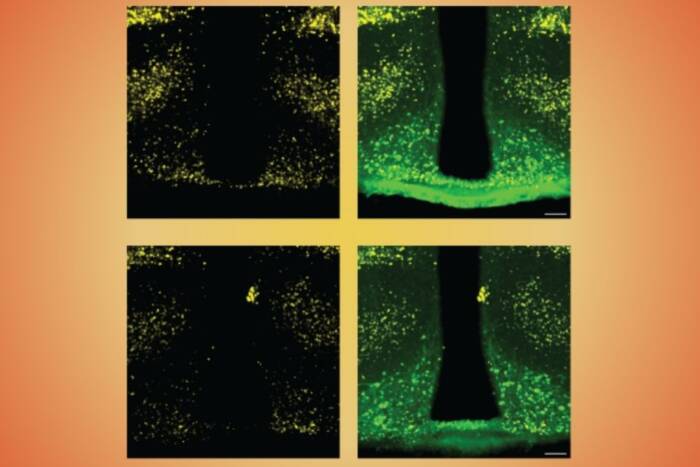 fluorescent imaging of PSTAT 3