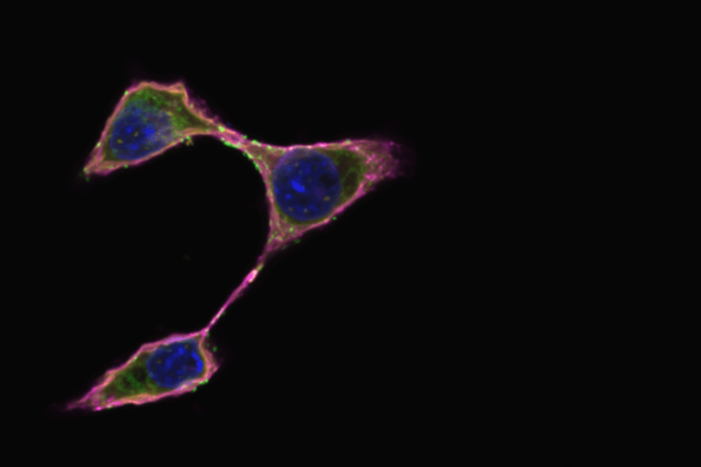 Glycosphingolipids (in pink, via Cholera Toxin B)