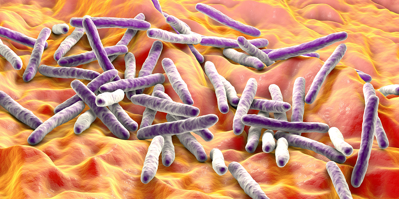 New Findings on TB Could Change How We Treat Inflammatory Disorders